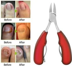 IGOODS Nagelriem Knipper - Professionele Teennagelknipper Cutter Tang - RVS - Zwart - Dikke Nagels Tool Gesneden Nagel - Teen Trimmer -Cosmeticawinkel 1200x1106 3