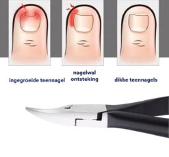 Medies - Professionele Zware Nageltang Voor Teennagels | Nagelknipper Teennagels | Ingegroeide Teennagel | Kalknagel | Harde Teennagels | Nagelschaar | Pedicure - Ingebouwde Veren -Cosmeticawinkel 1200x1113 3