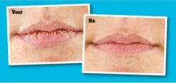 O'Keeffe's Lip Repair Verkoelend -Cosmeticawinkel 1200x568 1