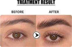 Flora Ruby - Wimper & Wenkbrauw Lifting Set 2 In 1 - Professionele 2 In 1 Lash Lift & Brow Lamination Kit - Permanente Wimperkruller -Cosmeticawinkel 1200x782 2