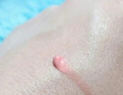 Biodermal Sun Lipbalm SPF25 - Tube 12 Ml - Natural Pink - Lippenbalsem 7 Biodermal Sun Lipbalm SPF25 - Tube 12 Ml - Natural Pink - Lippenbalsem -Cosmeticawinkel 1200x927