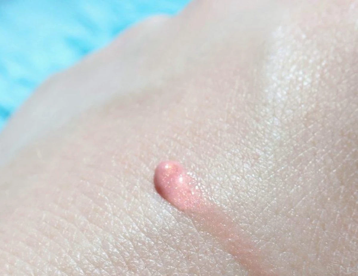 Biodermal Sun Lipbalm SPF25 - Tube 12 Ml - Natural Pink - Lippenbalsem 4 Biodermal Sun Lipbalm SPF25 - Tube 12 Ml - Natural Pink - Lippenbalsem - Afbeelding 4